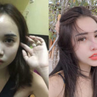 Tâm sự của cô gái phẫu thuật thẩm mỹ 77 Tâm sự của cô gái phẫu thuật thẩm mỹ