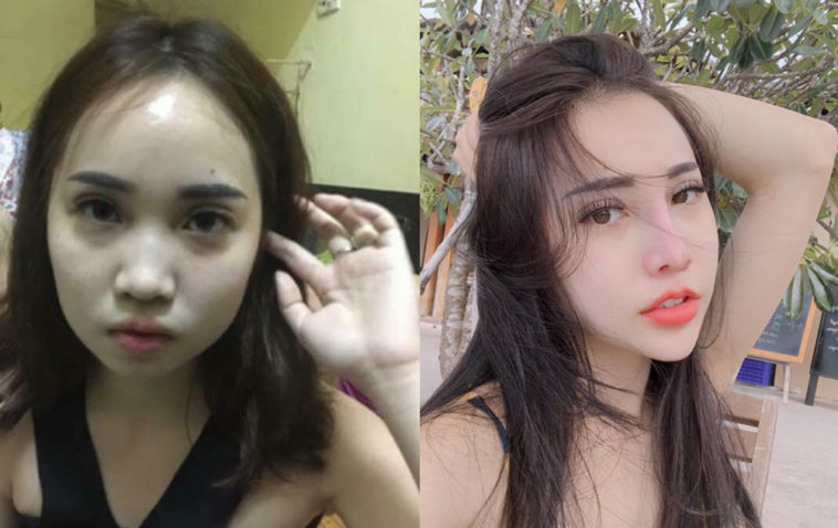 Tâm sự của cô gái phẫu thuật thẩm mỹ 13 Tâm sự của cô gái phẫu thuật thẩm mỹ